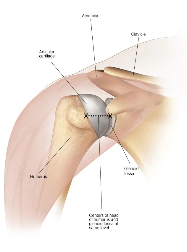 Revision hip and knee replacement surgery in Jaipur